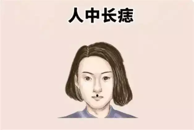 人中有痣的女人是不是寿命更短