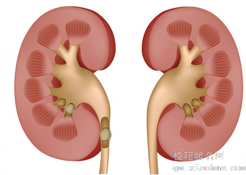 梦见肾痛 检查出问题